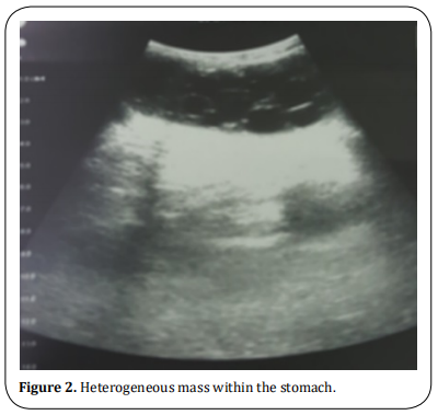 Figure 2.  